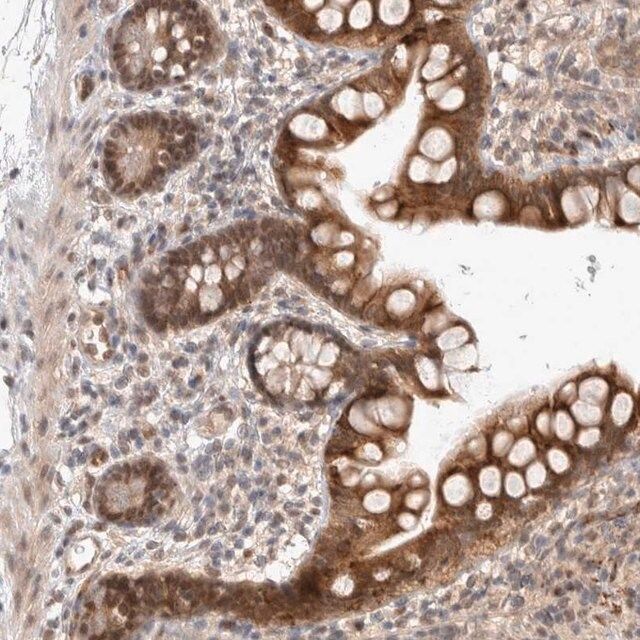 Anti-ZNF704 antibody produced in rabbit