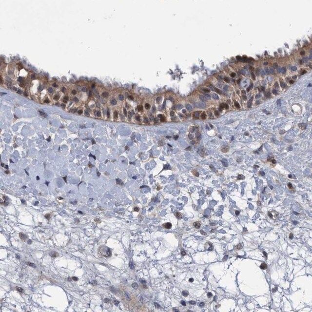 Anti-ZNF677 antibody produced in rabbit