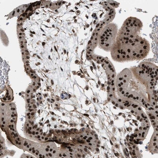 Anti-ZNF250 antibody produced in rabbit