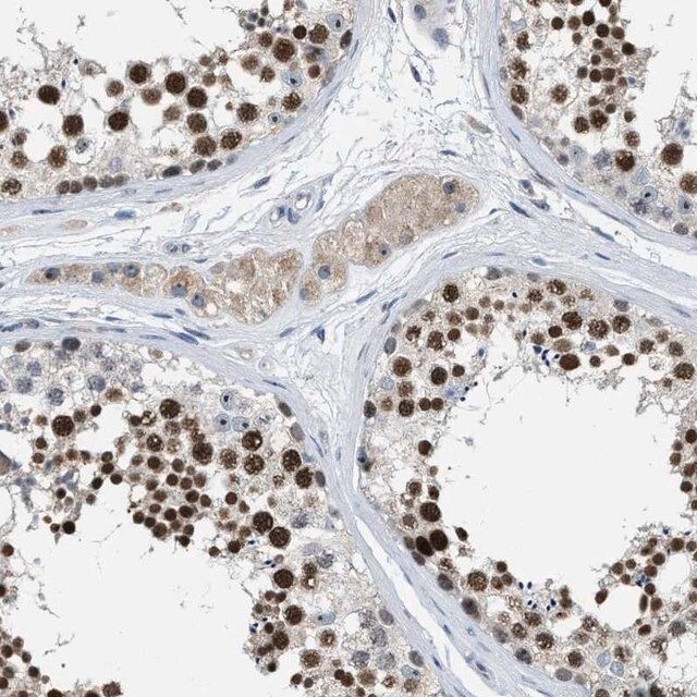 Anti-ZNF783 antibody produced in rabbit