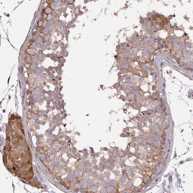 Anti-ZFYVE28 antibody produced in rabbit