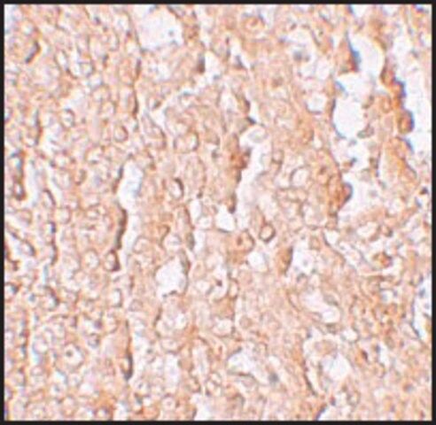 Anti-ZIP10 antibody produced in rabbit