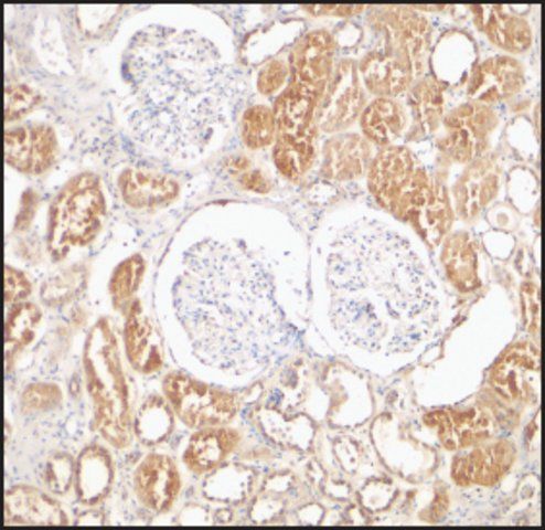 Anti-XIAP antibody produced in rabbit