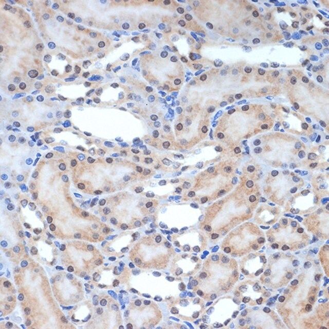 Anti-XPD/ERCC2 antibody produced in rabbit