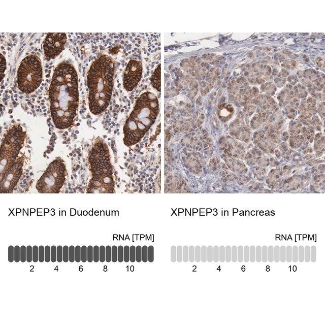 Anti-XPNPEP3 antibody produced in rabbit