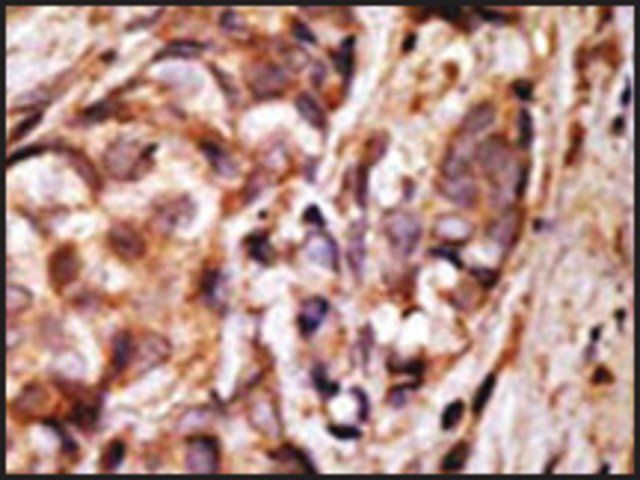 Anti-XLKD1 (C-term) antibody produced in rabbit