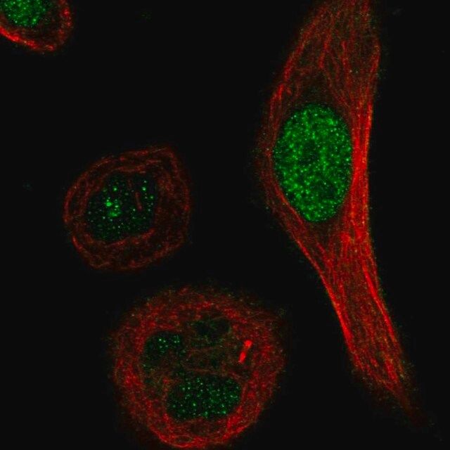 Anti-XRCC3 antibody produced in rabbit