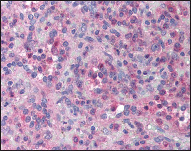 Anti-XIAP Associated Factor-1 antibody produced in rabbit