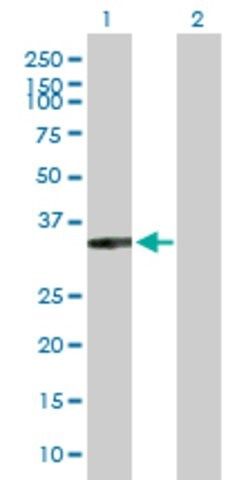 Anti-XRCC2 antibody produced in rabbit