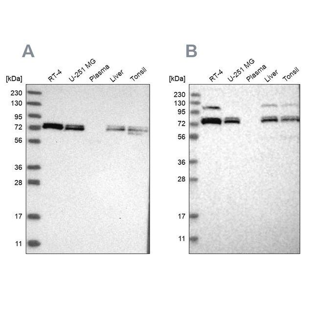 Anti-XPNPEP1 antibody produced in rabbit