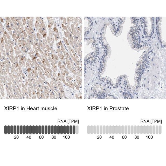 Anti-XIRP1 antibody produced in rabbit