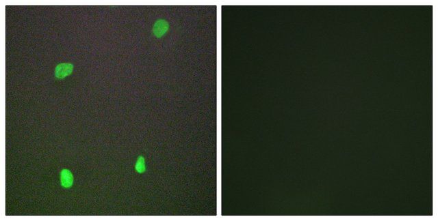 Anti-XRCC3 antibody produced in rabbit