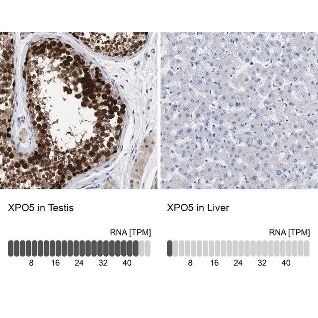 Anti-XPO5 antibody produced in rabbit