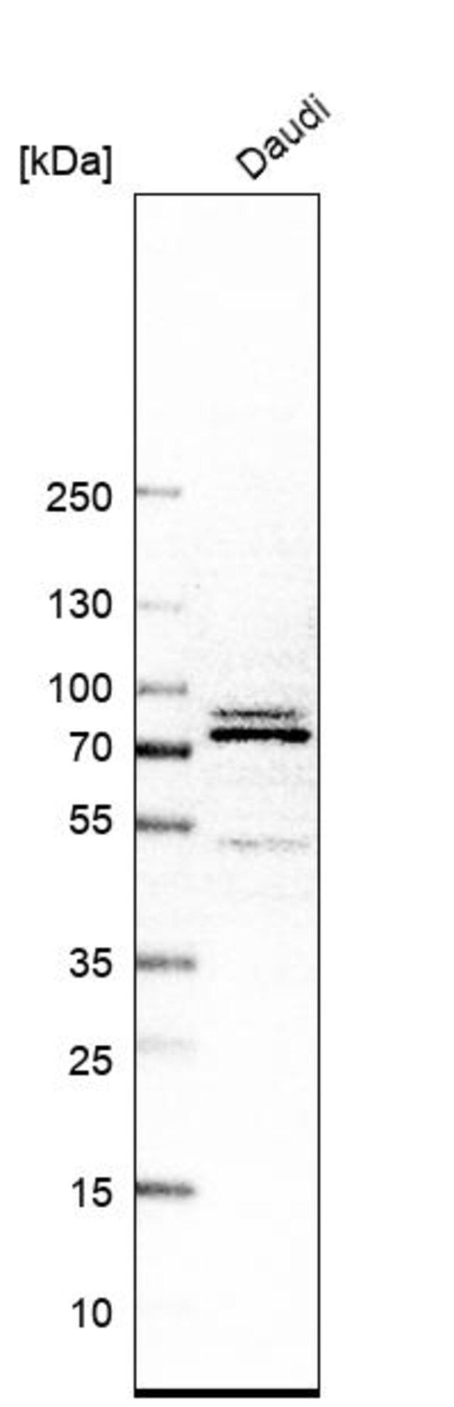 Anti-XPNPEP1 antibody produced in rabbit