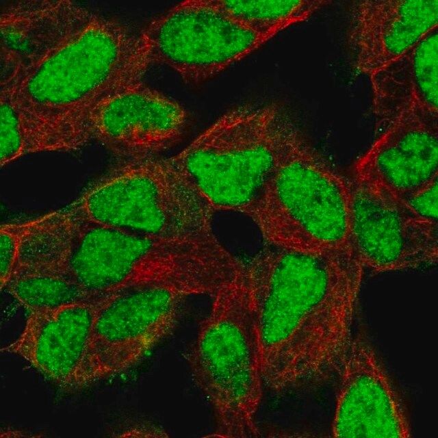 Anti-XRCC5 antibody produced in rabbit