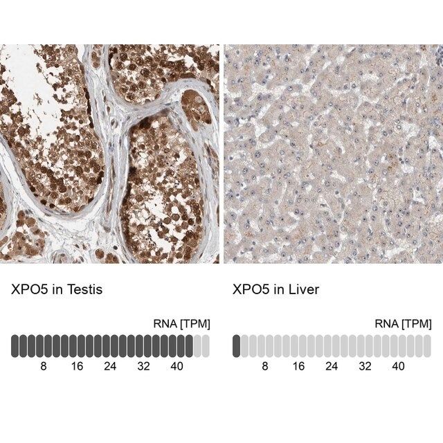 Anti-XPO5 antibody produced in rabbit