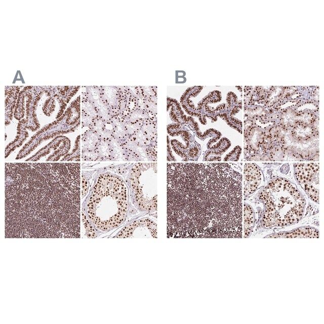 Anti-XRCC6 antibody produced in rabbit