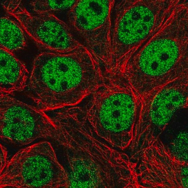 Anti-XPOT antibody produced in rabbit