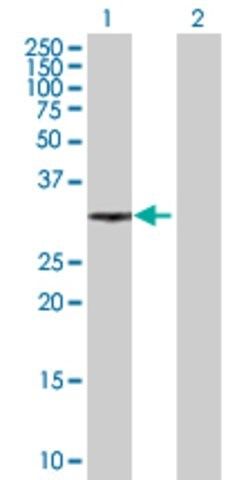 Anti-XRCC2 antibody produced in mouse