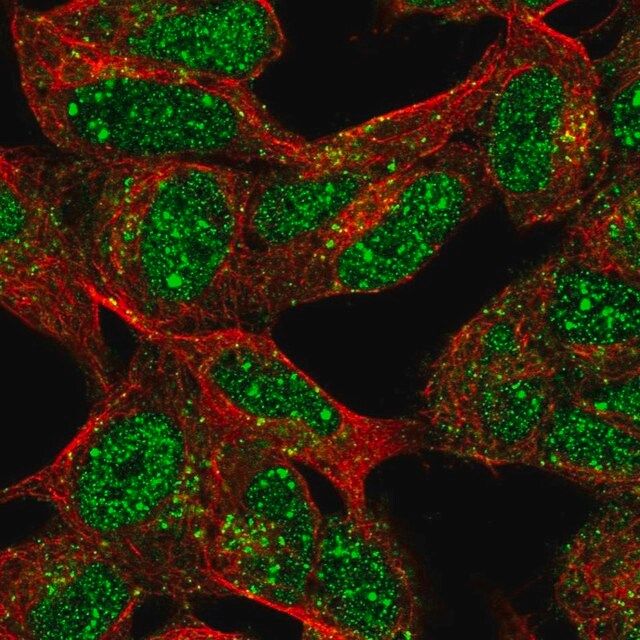 Anti-XRCC2 antibody produced in rabbit