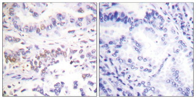 Anti-XRCC3 antibody produced in rabbit