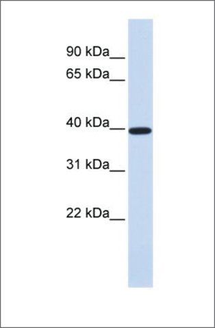 Anti-XRCC4 antibody produced in rabbit