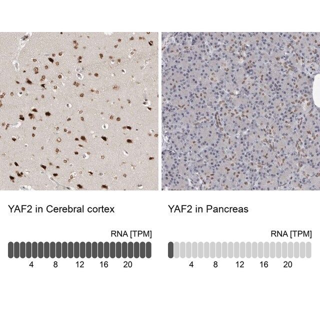 Anti-YAF2 antibody produced in rabbit