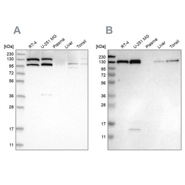 Anti-XPO5 antibody produced in rabbit