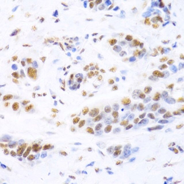 Anti-XRCC5 antibody produced in rabbit