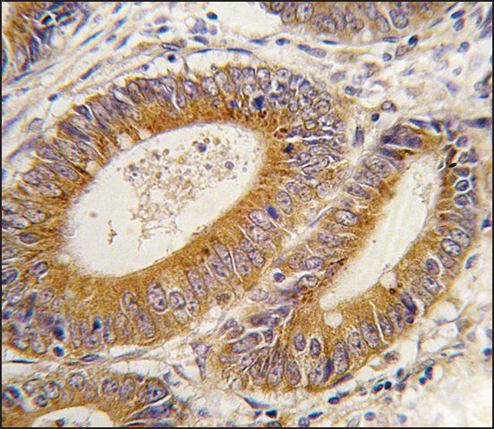 Anti-YARS2 (N-term) antibody produced in rabbit