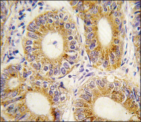 Anti-YARS2 (C-term) antibody produced in rabbit