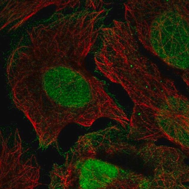 Anti-XPC antibody produced in rabbit