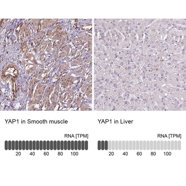 Anti-YAP1