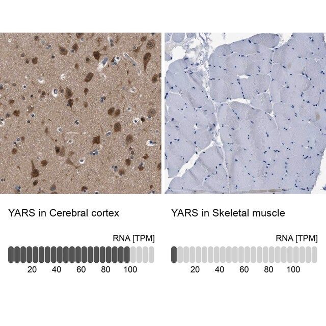 Anti-YARS antibody produced in rabbit