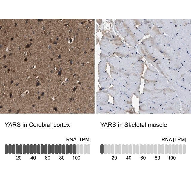 Anti-YARS antibody produced in rabbit