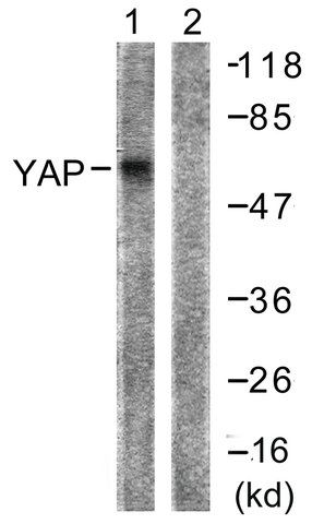 Anti-YAP antibody produced in rabbit