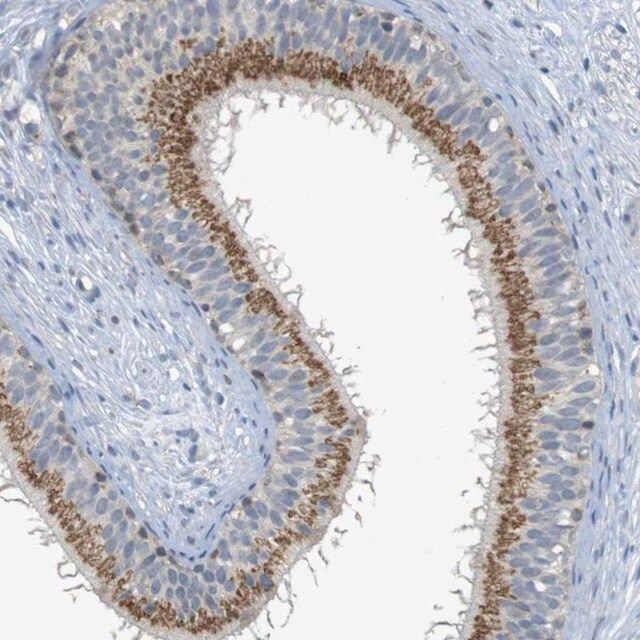 Anti-YIPF3 antibody produced in rabbit