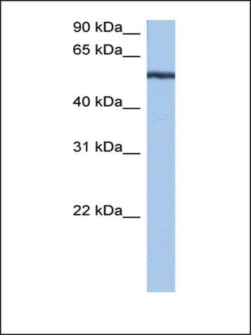 Anti-YARS antibody produced in rabbit