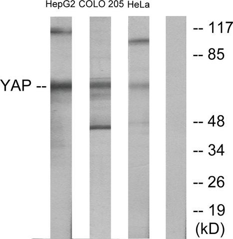 Anti-YAP antibody produced in rabbit