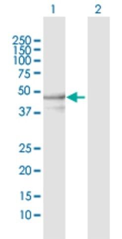 Anti-YARS2 antibody produced in rabbit