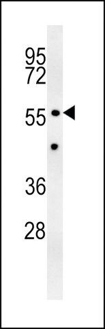 ANTI-Z385B (N-TERMINAL) antibody produced in rabbit