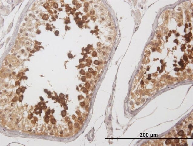 Anti-YBX2 antibody produced in mouse