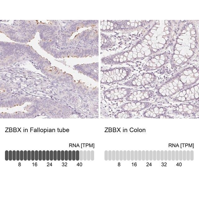 Anti-ZBBX antibody produced in rabbit