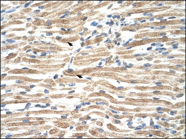 Anti-YAF2 antibody produced in rabbit