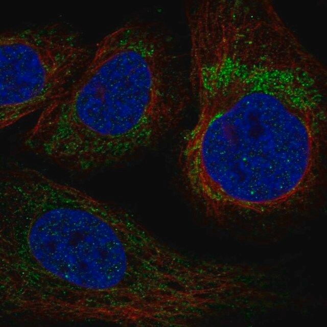 Anti-YARS2 antibody produced in rabbit