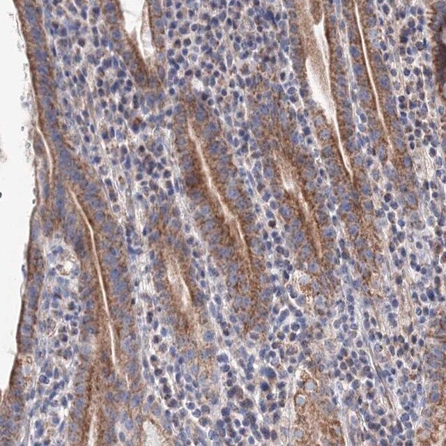 Anti-YARS2 antibody produced in rabbit