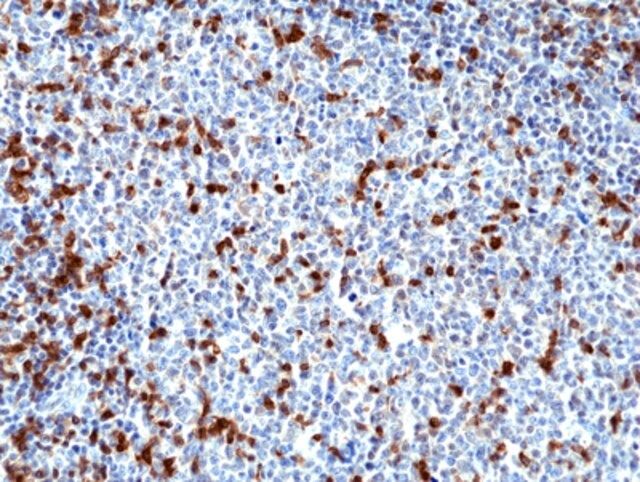 Anti-ZAP70 Rabbit Monoclonal Antibody