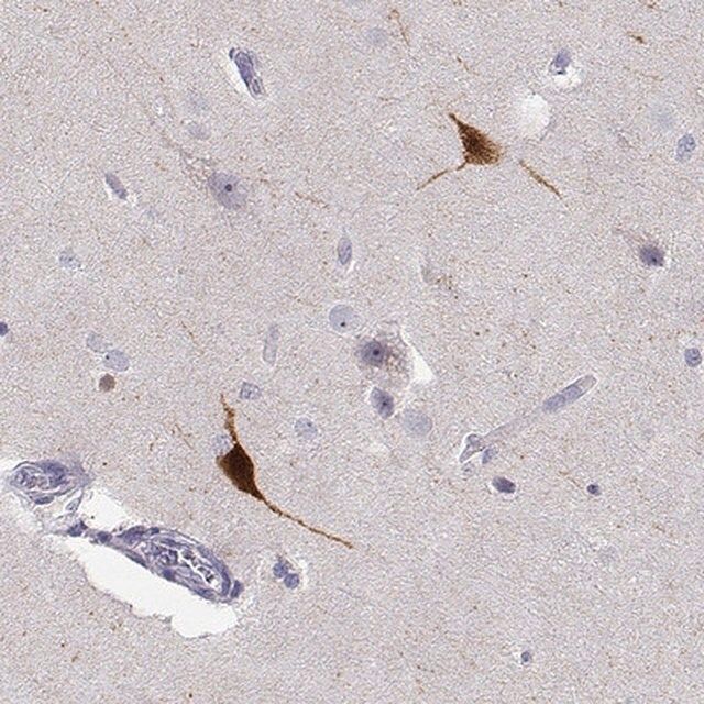 Anti-YJEFN3 antibody produced in rabbit