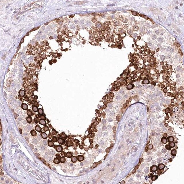 Anti-YBX3 antibody produced in rabbit