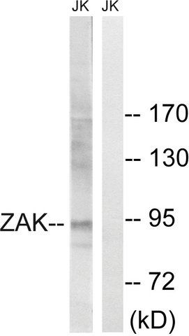 Anti-ZAK antibody produced in rabbit